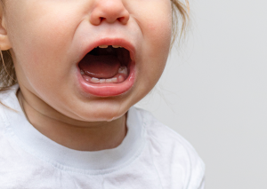 bebeklerde diş çıkarma ağrısına ne iyi gelir